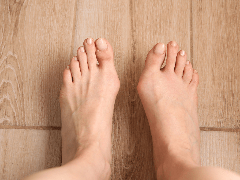 Congenital Deformities