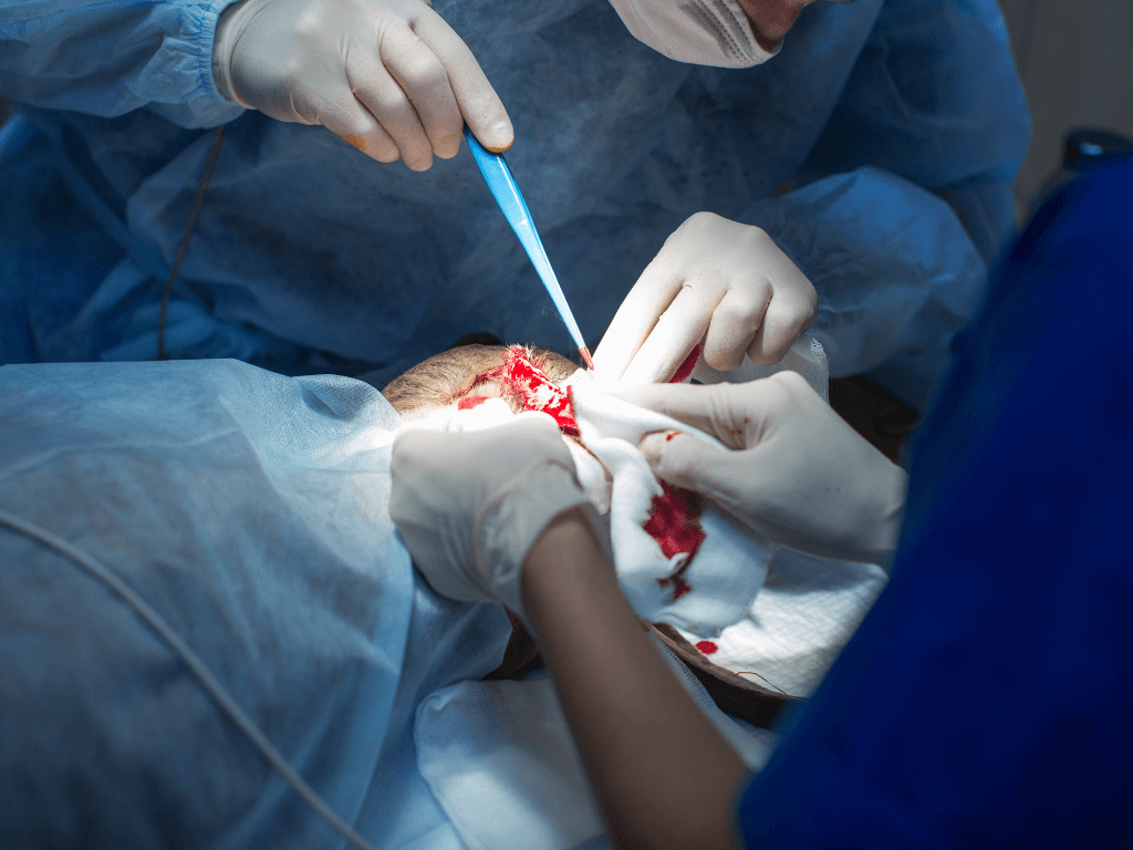 Cosmetic circumcision